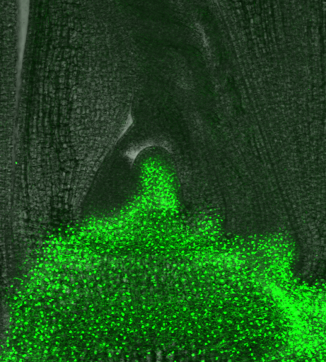 GFPを使った遺伝子発現解析